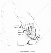 2_1_inserting_speculum