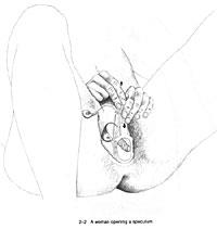 speculum_2 speculum_2