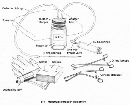 Menstrual Extraction - Womens Health Specialists - Womens Health Specialists